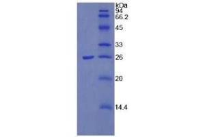 SDS-PAGE analysis of Mouse Pentraxin 3 Protein. (PTX3 Protéine)