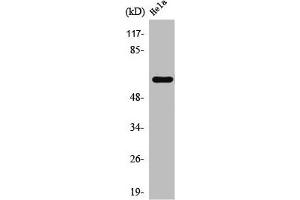 Western Blot analysis of HeLa cells using TBC1D3A/B/C Polyclonal Antibody (TBC1D3/TBC1D3B/TBC1D3C (C-Term) anticorps)