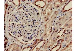 Immunohistochemistry of paraffin-embedded human kidney tissue using ABIN7168160 at dilution of 1:100 (PRPS2 anticorps  (AA 11-106))