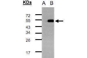 WB Image Western Blot analysis of TADA3L expression in transfected 293T cell line by TADA3L polyclonal antibody. (TADA3L anticorps  (C-Term))