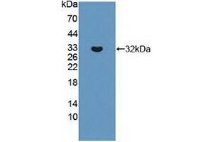 ABCC8 anticorps  (AA 679-929)