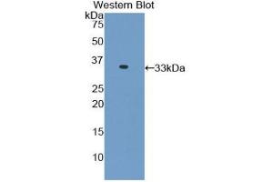 Western blot analysis of the recombinant protein. (TNNI3 anticorps  (AA 1-211))