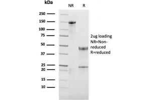 SDS-PAGE Analysis Purified OX40 Mouse Monoclonal Antibody (OX40/3108).