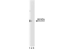 Western blot analysis of EAAT2 on a rat cerebrum lysate.