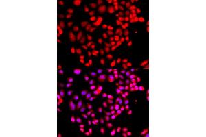 Immunofluorescence analysis of  cells using RPS6KL1 antibody (ABIN6130681, ABIN6147242, ABIN6147243 and ABIN6223376). (RPS6KL1 anticorps  (AA 1-130))
