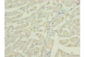Immunohistochemistry of paraffin-embedded human heart tissue using ABIN7166300 at dilution of 1:100