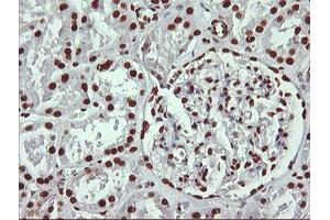 Image no. 8 for anti-THUMP Domain Containing 1 (THUMPD1) antibody (ABIN1501384) (THUMPD1 anticorps)