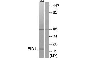 Western blot analysis of extracts from HeLa cells, using EID1 antibody. (EID1 anticorps  (Internal Region))