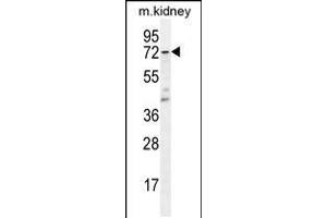 Western blot analysis in mouse kidney tissue lysates (35ug/lane). (TBXAS1 anticorps  (AA 226-257))