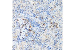 Immunohistochemistry of paraffin-embedded Mouse cartilage using Aggrecan Rabbit pAb (ABIN6127417, ABIN6136406, ABIN6136408 and ABIN6224631) at dilution of 1:50 (40x lens).
