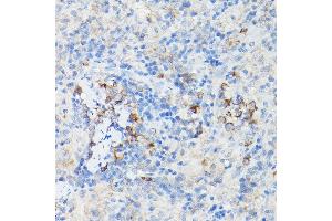 Immunohistochemistry of paraffin-embedded Mouse cartilage using Aggrecan Rabbit pAb (ABIN6127417, ABIN6136406, ABIN6136408 and ABIN6224631) at dilution of 1:50 (40x lens). (Aggrecan anticorps  (AA 20-280))