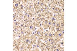 Immunohistochemistry of paraffin-embedded human liver injury using ST3GAL3 antibody. (ST3GAL3 anticorps  (AA 30-375))