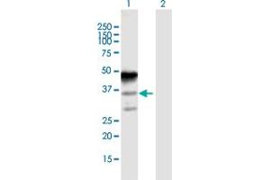 Western Blot analysis of MAGEA8 expression in transfected 293T cell line by MAGEA8 MaxPab polyclonal antibody. (MAGEA8 anticorps  (AA 1-318))