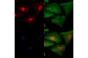 Phospho-SALL1 (Ser941) Antibody staining A549 cells(H2O2 treatment) by IF/ICC. (SALL1 anticorps  (pSer941))