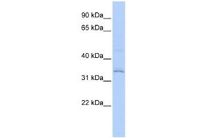 WB Suggested Anti-RNF113A Antibody Titration:  0. (RNF113A anticorps  (Middle Region))