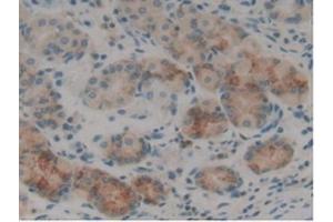 Detection of SELL in Human Stomach Tissue using Polyclonal Antibody to Selectin, Leukocyte (SELL) (L-Selectin anticorps  (AA 109-346))