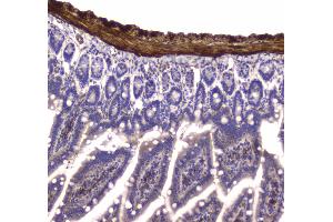 IHC analysis of MYLK using anti-MYLK antibody . (MYLK anticorps  (AA 1441-1709))
