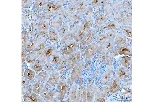 IHC analysis of PAH using anti-PAH antibody (ABIN5518942).