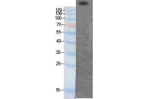 Western Blotting (WB) image for anti-CREB Binding Protein (CREBBP) (acLys1535) antibody (ABIN3181878) (CBP anticorps  (acLys1535))