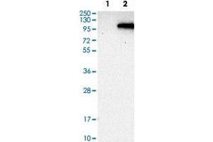 Western Blot analysis of Lane 1: negative control (vector only transfected HEK293T cell lysate) and Lane 2: over-expression lysate (co-expressed with a C-terminal myc-DDK tag in mammalian HEK293T cells) with PDE6A polyclonal antibody . (PDE6A anticorps)