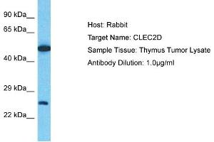 Host: Rabbit Target Name: CLEC2D Sample Type: Thymus Tumor lysates Antibody Dilution: 1. (CLEC2D anticorps  (C-Term))