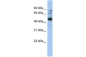 WB Suggested Anti-PRAME Antibody Titration: 0. (PRAME anticorps  (N-Term))