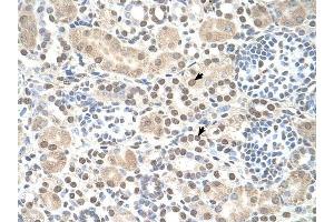 ST8SIA2 antibody was used for immunohistochemistry at a concentration of 4-8 ug/ml to stain Epithelial cells of renal tubule (arrows) in Human Kidney. (ST8SIA2 anticorps  (C-Term))
