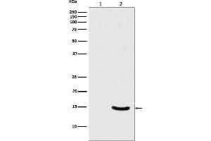 Western blot analysis of Phospho-alpha Synuclein (Ser129) expression in (1) 293T cell lysate, (2) 293T cell lysate transfected with Polo-Like Kinase 2 and alpha Synuclein.