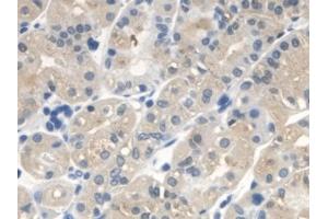 Detection of OXCT1 in Human Stomach Tissue using Polyclonal Antibody to 3-Oxoacid Coenzyme A Transferase 1 (OXCT1) (OXCT1 anticorps  (AA 40-489))