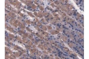 Detection of LCT in Rat Stomach Tissue using Polyclonal Antibody to Lactase (LCT) (LCT anticorps  (AA 33-291))