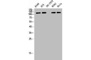 Western Blot analysis of A549 NIH-3T3 SH-SY5Y K562 HELA cells using Phospho-Tensin-2 (Y483) Polyclonal Antibody (TENC1 anticorps  (pTyr483))