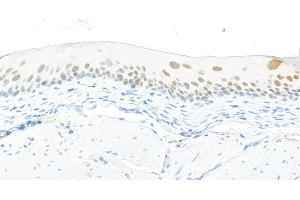 Immunohistochemistry (IHC) image for anti-Forkhead Box Q1 (FOXQ1) (AA 353-403) antibody (ABIN7455177) (Recombinant FOXQ1 anticorps  (AA 353-403))