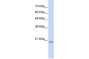 WB Suggested Anti-PFDN6 Antibody Titration: 0. (PFDN6 anticorps  (N-Term))