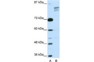WB Suggested Anti-GTF2I Antibody   Titration: 2. (GTF2I anticorps  (N-Term))