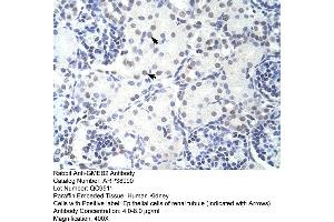 Human kidney (GMEB2 anticorps  (C-Term))