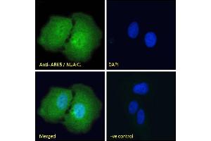 ABIN570930 Immunofluorescence analysis of paraformaldehyde fixed U2OS cells, permeabilized with 0. (NUAK1 anticorps  (Internal Region))