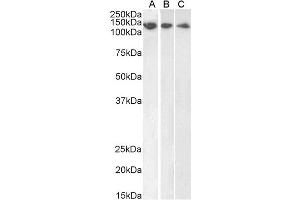 ABIN184570 (1µg/ml) staining of HeLa (A), HepG2 (B) and Jurkat (C) lysate (35µg protein in RIPA buffer). (DDB1 anticorps  (C-Term))