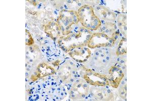 Immunohistochemistry of paraffin-embedded rat kidney using UQCR10 antibody at dilution of 1:100 (x40 lens). (UQCR10 anticorps)