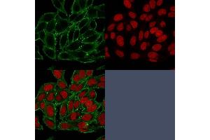 Immunofluorescent staining of paraformaldehyde-fixed HeLa cells.