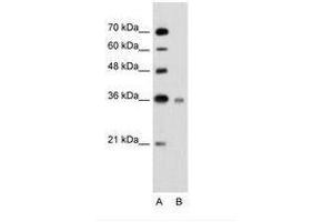 Image no. 3 for anti-Ubiquitin-Conjugating Enzyme E2, J1, U (UBE2J1) (N-Term) antibody (ABIN203528)