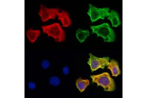 ABIN6262671 and ABIN6273002 staining Hela cells by IF/ICC. (ISCU anticorps  (Internal Region))