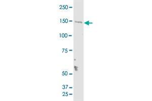 TMEM1 monoclonal antibody (M01), clone 5B4. (TRAPPC10 anticorps  (AA 1162-1257))