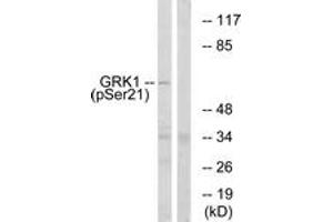 anti-G Protein-Coupled Receptor Kinase 1 (GRK1) (AA 6-55), (pSer21) antibody