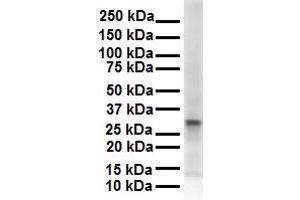 WB Suggested Anti-ECHDC2 antibody Titration: 1 ug/mL Sample Type: Human 721_B (ECHDC2 anticorps  (Middle Region))