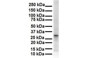 WB Suggested Anti-ECHDC2 antibody Titration: 1 ug/mL Sample Type: Human 721_B (ECHDC2 anticorps  (Middle Region))