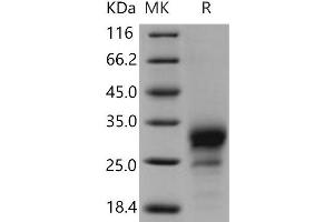 Western Blotting (WB) image for Tumor Necrosis Factor Receptor Superfamily, Member 19 (TNFRSF19) protein (His tag) (ABIN7198467) (TNFRSF19 Protein (His tag))