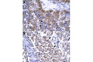 Immunohistochemical staining (Formalin-fixed paraffin-embedded sections) of human liver (A) and human muscle (B) with ERCC8 polyclonal antibody  at 4-8 ug/mL working concentration. (ERCC8 anticorps  (C-Term))