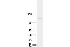 Validation with Western Blot