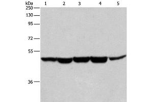 Western Blot analysis of Human bladder cancer tissue, A375, K562, Hela and HepG2 cell using HNRNP F Polyclonal Antibody at dilution of 1:350 (HNRNPF anticorps)