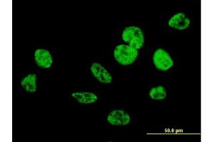 Immunofluorescence of purified MaxPab antibody to CIP29 on HeLa cell. (SARNP anticorps  (AA 1-210))